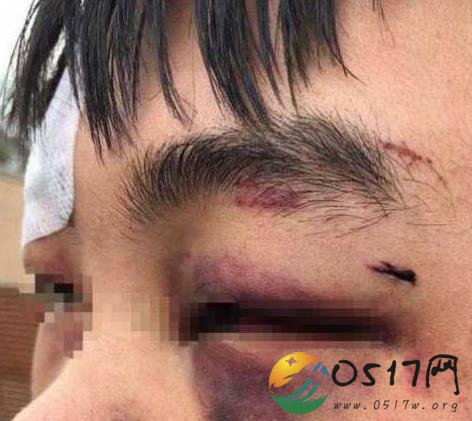 中国留学生在澳洲被殴打 遭到当地青少年团体攻击