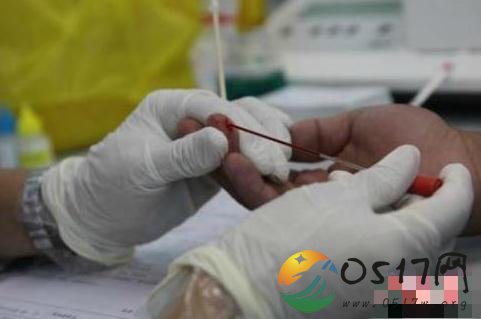 一滴血可验败血症 一滴血就能做检查了吗