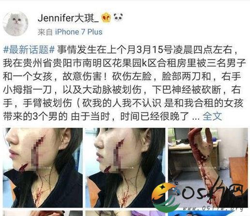 女孩被砍毁容 当时究竟发生了什么事情