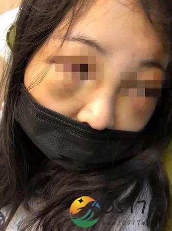 女生打呼噜遭群殴 身体心理都受到重创