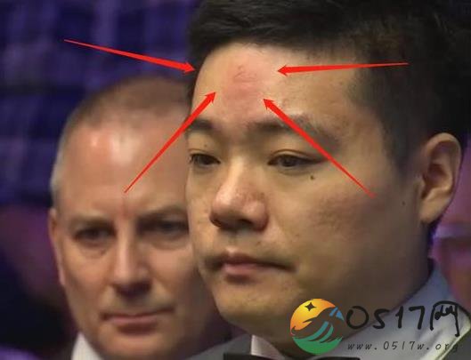 丁俊晖晋级不忘开玩笑 只因专心比赛额头被撞
