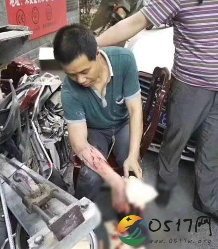 干部驾奥迪车撞农民工 叫嚣我撞你有钱赔