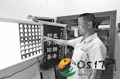 病人脑出血无亲人签字 医生冒着风险做手术