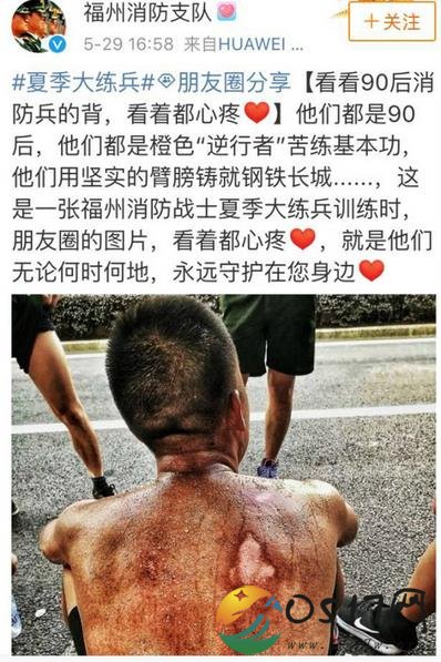 90后消防员的背走红 消防员的伤疤究竟从何而来的