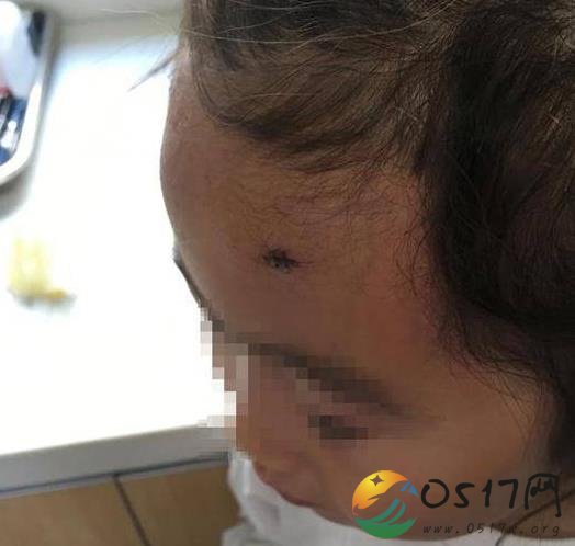 女孩迪士尼撞灯柱 第三方公估公司认为园方无责