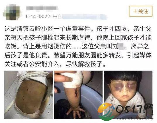 4岁女童疑遭虐待 亲生父亲被警方带走调查