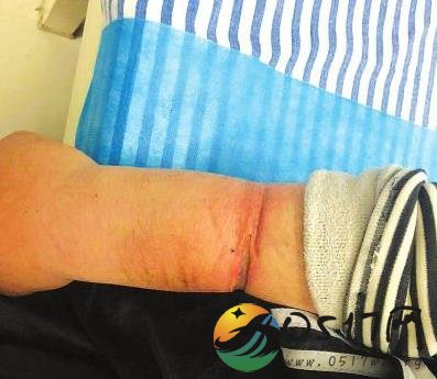 少年捡手铐铐自己 试图解开手铐无果直到感到疼痛才求助