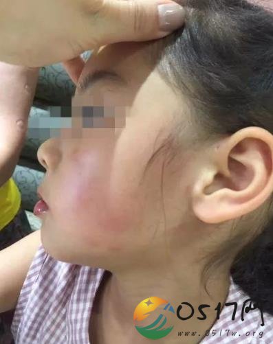 4岁女孩被掌掴 只因两个孩子游乐场抢玩具起争执