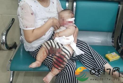 大狗叼走半岁宝宝 最终被好心人救下