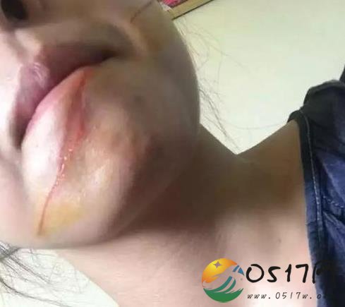 女孩走在路上鲜血直流 好好的怎么会流血