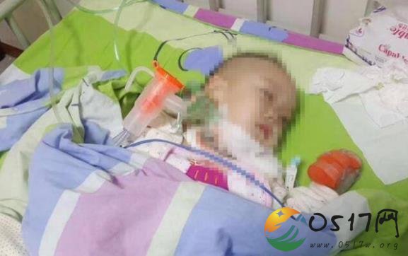 两岁孩子患艾滋 父母都没有艾滋孩子如何患上艾滋的