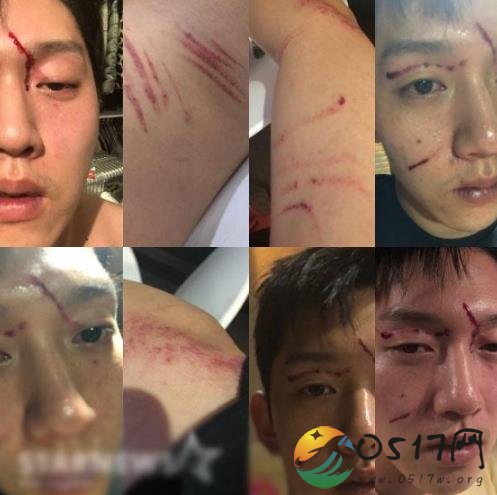 具荷拉前男友受伤照曝光 具荷拉是如何回应的