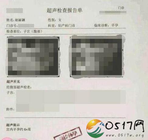 赵丽颖方回应B超照 只是同名同姓的人怀孕而已