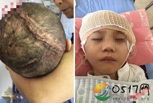 陕西渭南继母虐童案将开庭 可是孩子还没有醒过来