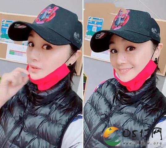 曹颖手术后现身看起来不错 曹颖究竟做了什么手术