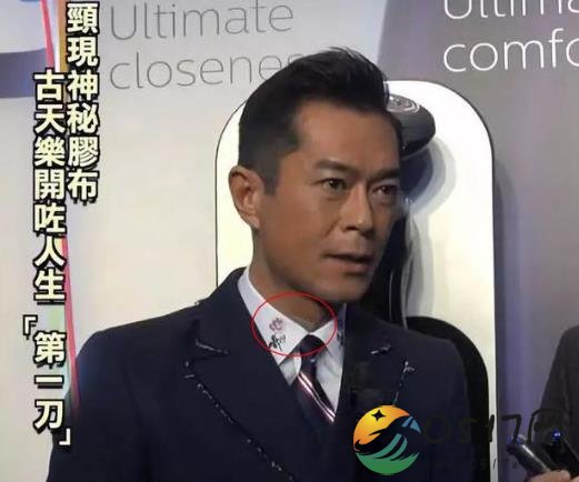 古天乐颈椎移位 做完手术后脖子上还有胶布
