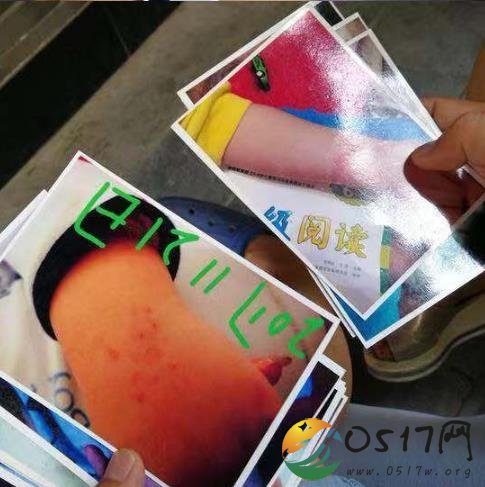 幼儿园老师背摔幼儿 甚至还威胁学生家长