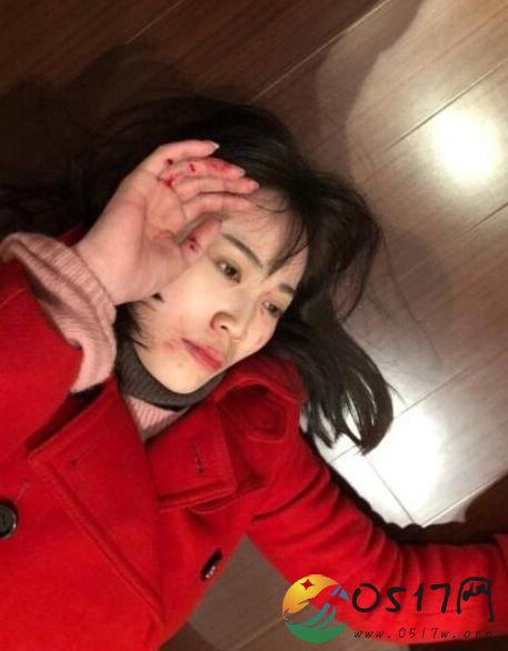 马蓉称被严重打伤 马蓉为何会被打伤